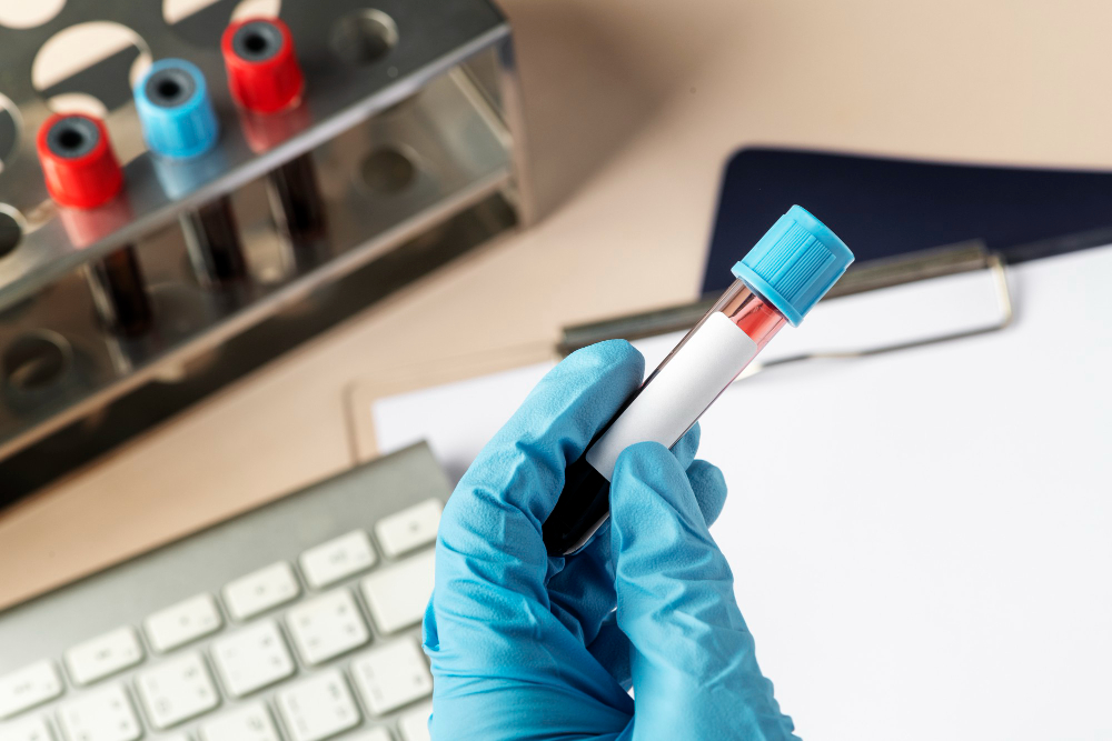 How ACE Inspection Supports Blood Banks